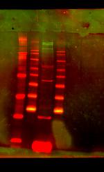 RBP1 Antibody in Western Blot (WB)