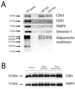 FABP4 Antibody in Western Blot (WB)