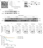 TSG101 Antibody in Western Blot (WB)