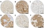 DKK1 Antibody in Immunohistochemistry (IHC)