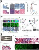 PARP1 Antibody in Immunohistochemistry (IHC)