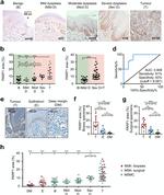 PARP1 Antibody in Immunohistochemistry (IHC)