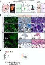 PARP1 Antibody in Immunohistochemistry (IHC)