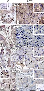 PPAR delta Antibody in Immunohistochemistry (IHC)