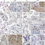 TSPO Antibody in Immunohistochemistry (IHC)