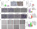 CPT1A Antibody in Immunohistochemistry (IHC)