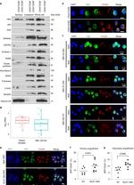 GPI Antibody in Western Blot (WB)