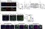 ACE2 Antibody in Immunohistochemistry (IHC)