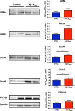 NMDAR2B Antibody in Western Blot (WB)