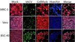 Vaccinia Virus Antibody in In vitro Assay (IV)