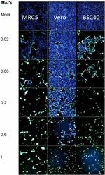 Vaccinia Virus Antibody in In vitro Assay (IV)