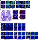 CD140b (PDGFRB) Antibody in Immunohistochemistry (IHC)