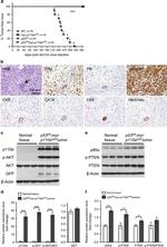 ErbB2 (HER-2) Antibody in Immunohistochemistry (Paraffin) (IHC (P))