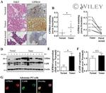 Calcium Sensing Receptor Antibody in Western Blot, Immunocytochemistry (WB, ICC/IF)