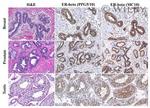 Estrogen Receptor beta Antibody in Immunohistochemistry (IHC)