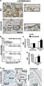 Syndecan 2 Antibody in Immunohistochemistry (IHC)