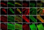 SERCA2 ATPase Antibody in Immunocytochemistry (ICC/IF)