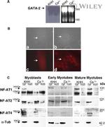 NFATC2 Antibody in Western Blot (WB)