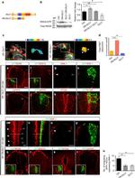 N-cadherin Antibody in Immunohistochemistry (IHC)