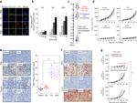 FOXP3 Antibody in Immunohistochemistry (IHC)