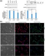 Vimentin Antibody in Immunocytochemistry (ICC/IF)