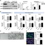 UCP1 Antibody in Immunocytochemistry, Immunohistochemistry (Paraffin) (ICC/IF, IHC (P))