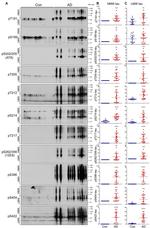 Phospho-Tau (Thr205) Antibody in Western Blot (WB)