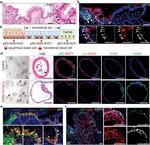 AGR2 Antibody in Immunocytochemistry, Immunohistochemistry (ICC/IF, IHC)