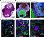 Alpha-Smooth Muscle Actin Antibody in Immunohistochemistry (IHC)