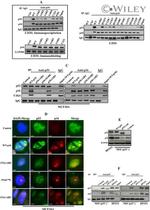 p19ARF Antibody in Immunoprecipitation (IP)