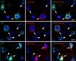 Phospho-Tau (Thr205) Antibody in Immunocytochemistry (ICC/IF)