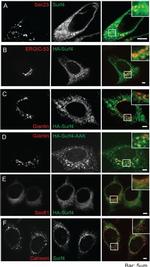 Calnexin Antibody in Immunocytochemistry (ICC/IF)