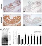 Nitrotyrosine Antibody in Immunohistochemistry (IHC)