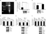 SQSTM1 Antibody in Western Blot (WB)