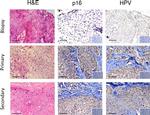 CD45 Antibody in Immunocytochemistry (ICC/IF)