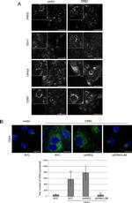 CD63 Antibody in Immunocytochemistry (ICC/IF)