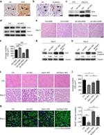 DVL2 Antibody in Immunohistochemistry (IHC)