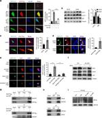 DVL2 Antibody in Immunocytochemistry (ICC/IF)