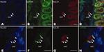 HuC/HuD Antibody in Immunohistochemistry (IHC)