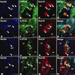 HuC/HuD Antibody in Immunohistochemistry (IHC)