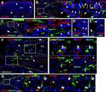 CD166 (ALCAM) Antibody in Immunohistochemistry (IHC)