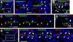 CD166 (ALCAM) Antibody in Immunohistochemistry (IHC)