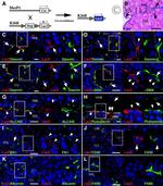 CD166 (ALCAM) Antibody in Immunohistochemistry (IHC)