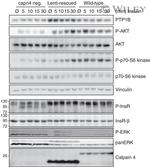 Phospho-IR/IGF1R (Tyr1162, Tyr1163) Antibody in Western Blot (WB)