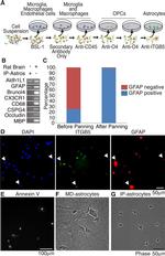 Integrin beta 5 Antibody in Immunocytochemistry (ICC/IF)