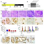 Claudin 18 Antibody in Immunohistochemistry (IHC)