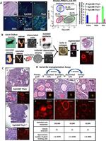 CD326 (EpCAM) Antibody in Immunohistochemistry (IHC)