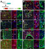 Podoplanin Antibody in Immunohistochemistry (IHC)