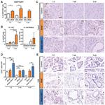 FOXP3 Antibody in Immunohistochemistry (IHC)