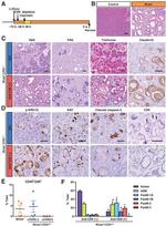 Claudin 18 Antibody in Immunohistochemistry (IHC)